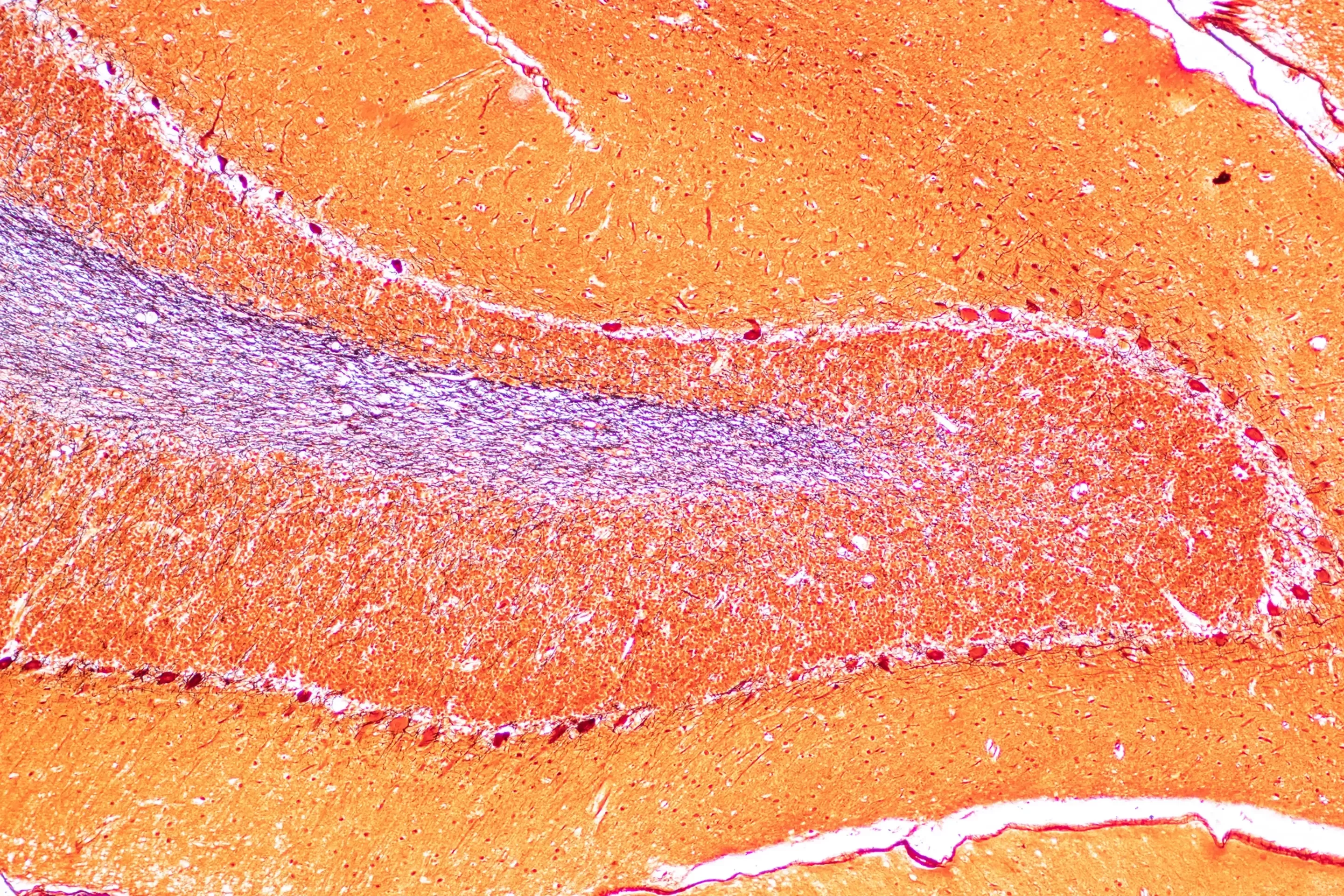 Mikroskopische Ansicht von Gehirngewebe mit leuchtend orangen und violetten Bereichen und dichten Zellstrukturen. Der Ton ist wissenschaftlich und detailliert.